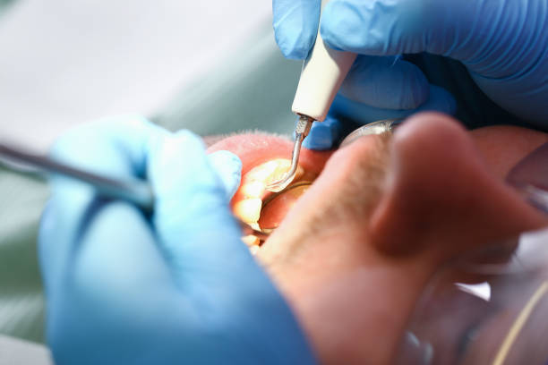 Best Emergency Tooth Extraction in Chase City, VA