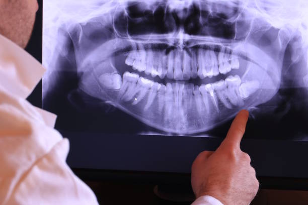 Best Emergency Root Canal Treatment in Chase City, VA